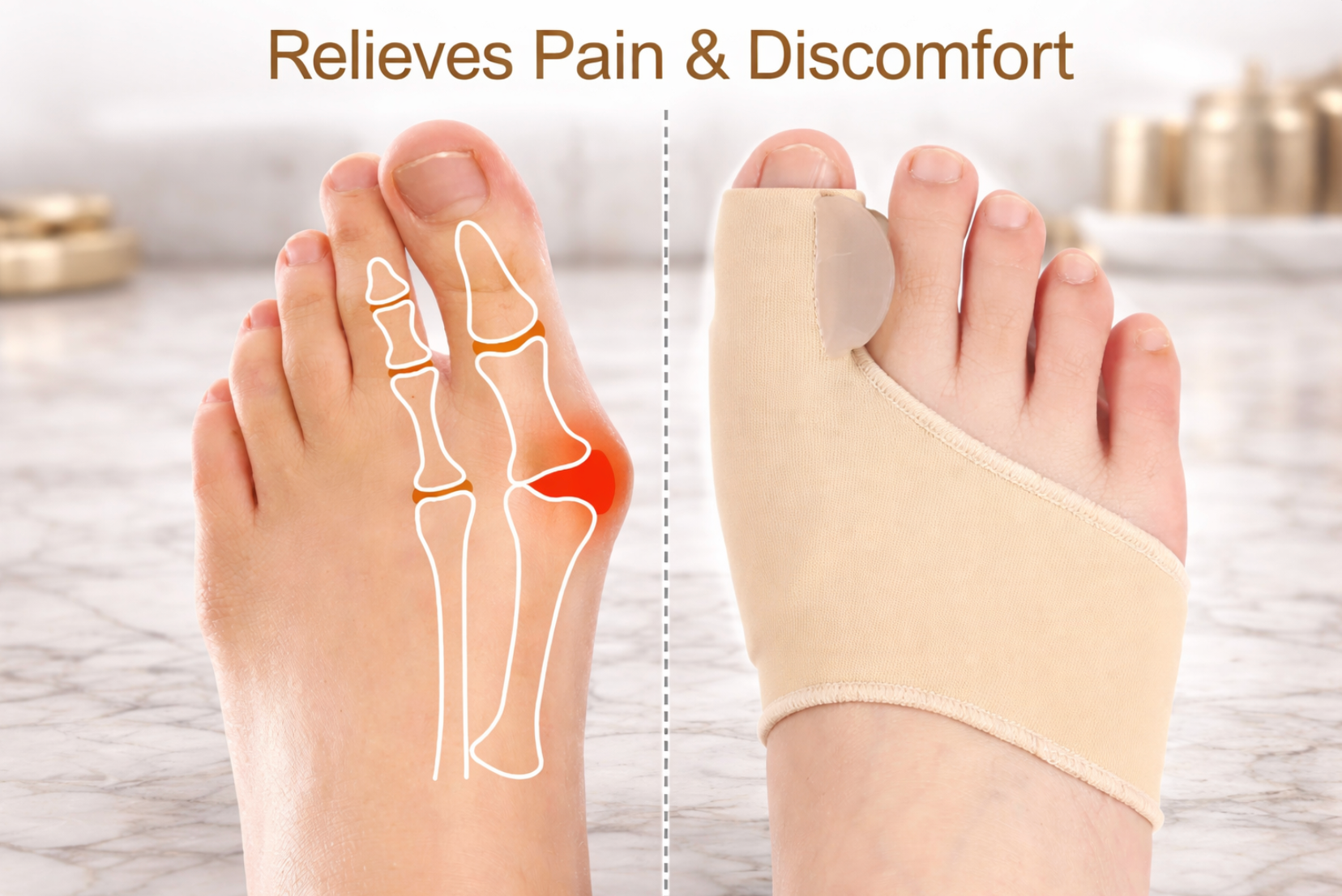 Day & Night Bunion Corrector